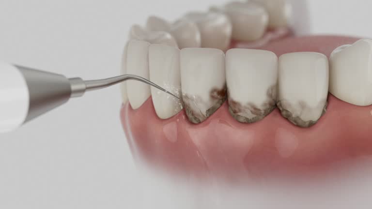 Reliable Dental contractor in Progress, PA by Smile Center Dentistry